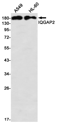 IQGAP2 Rabbit mAb
