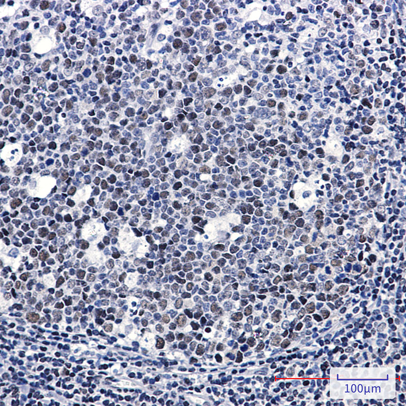 LIG1 Rabbit mAb