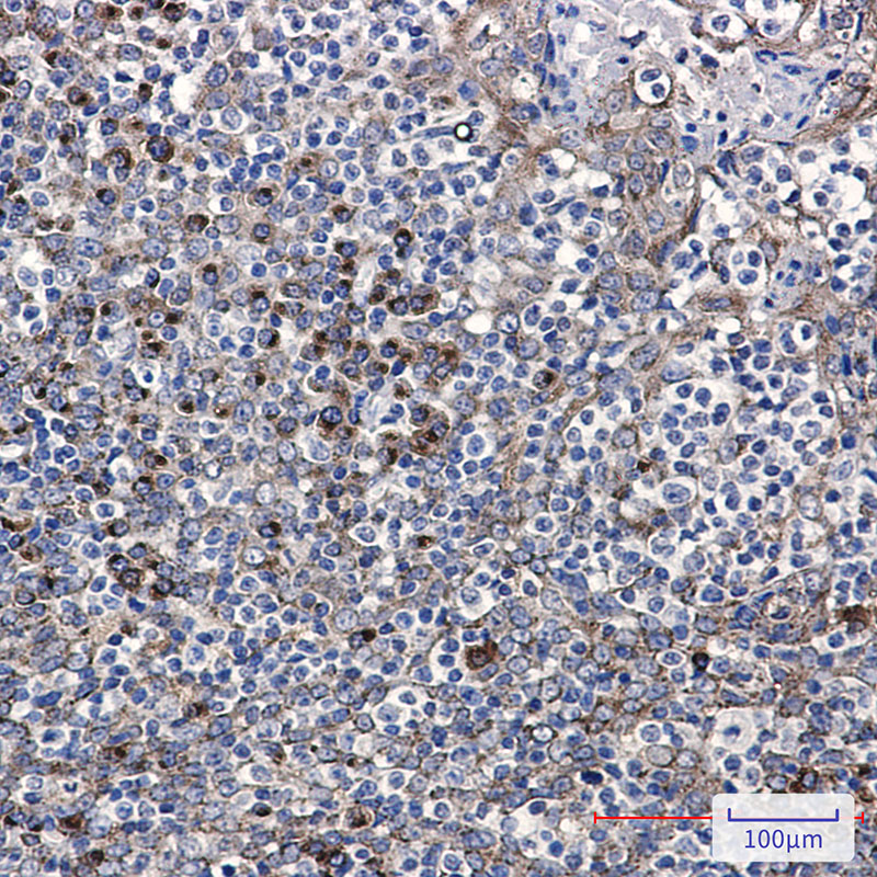 LMAN1 Rabbit mAb