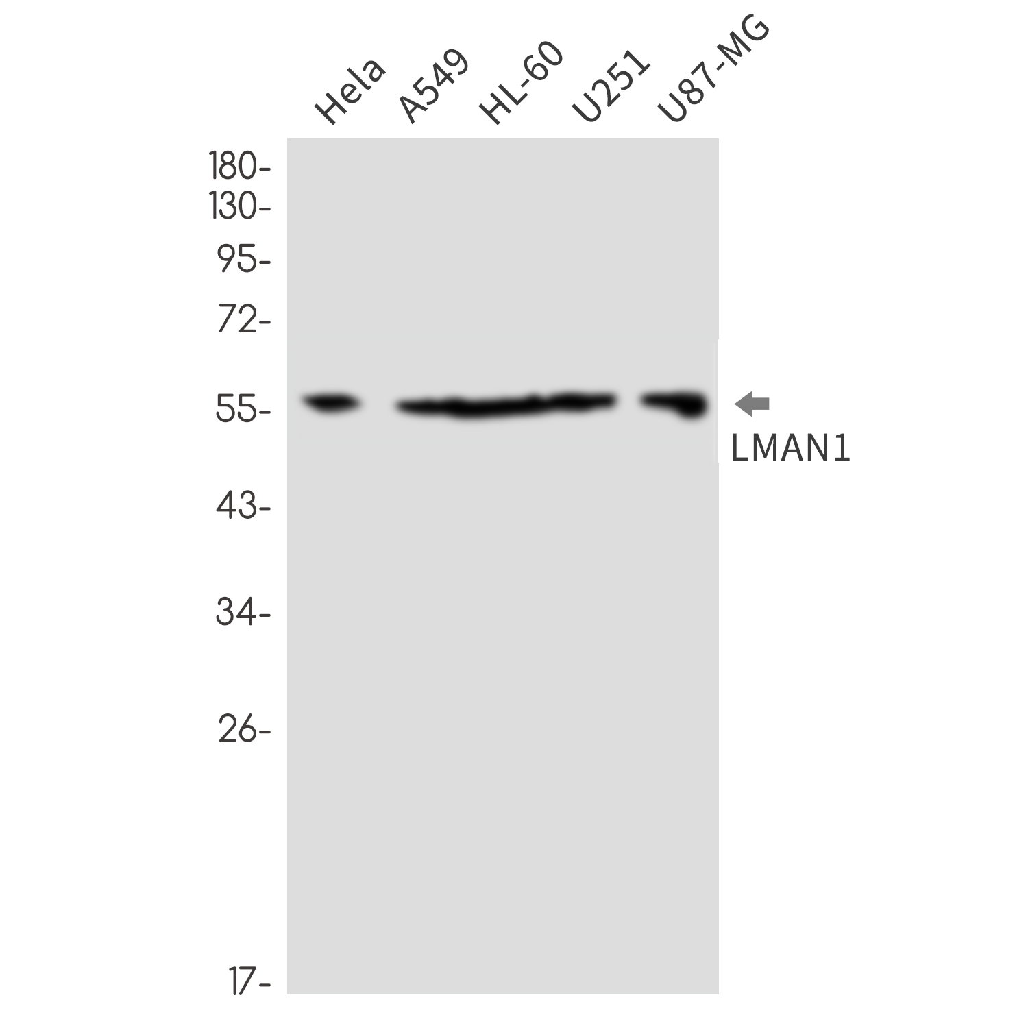 LMAN1 Rabbit mAb