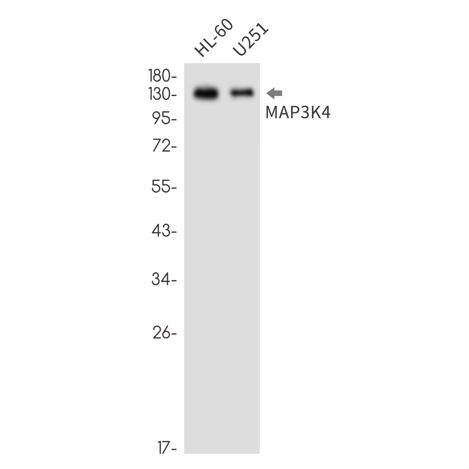 MAP3K4 Rabbit mAb