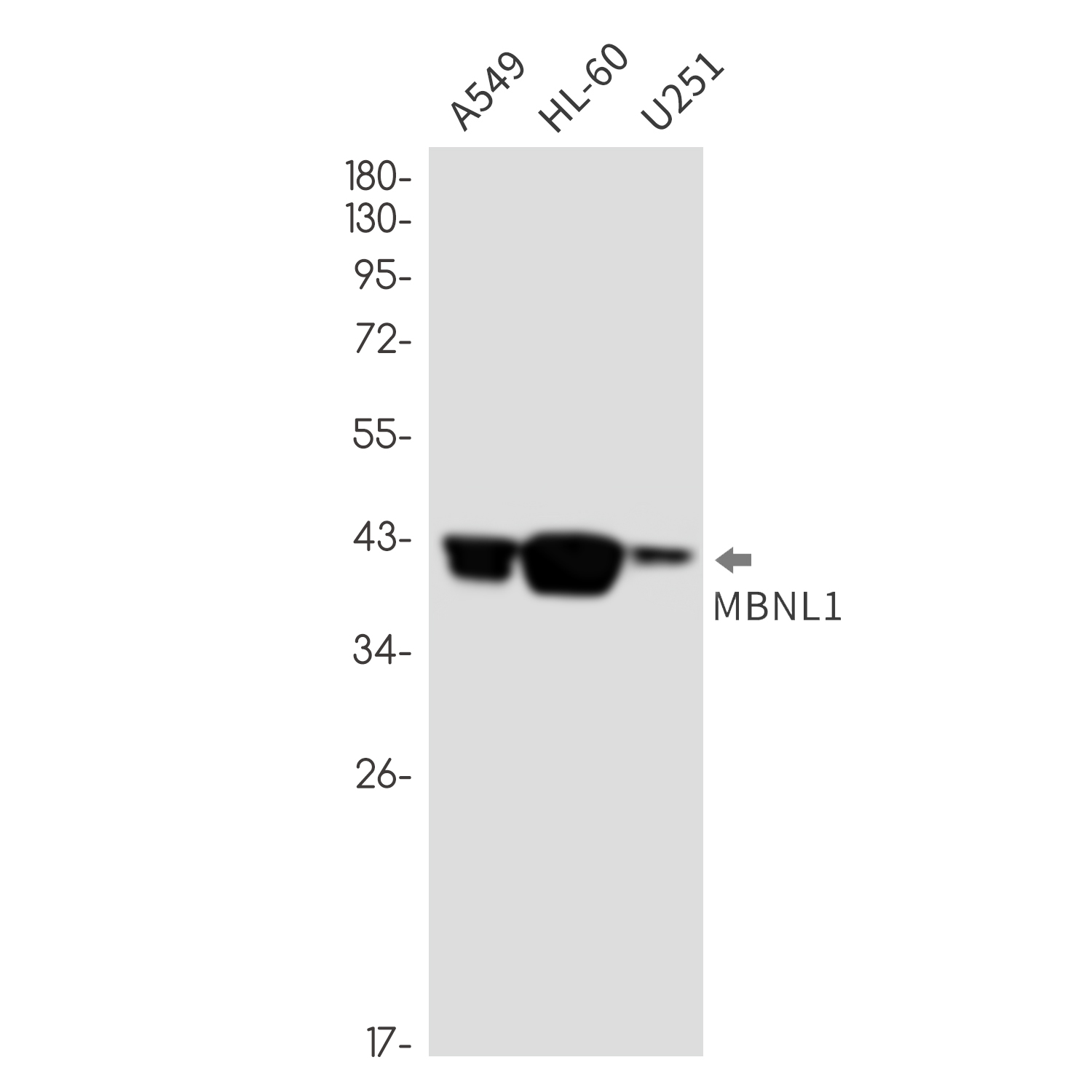 MBNL1 Rabbit mAb