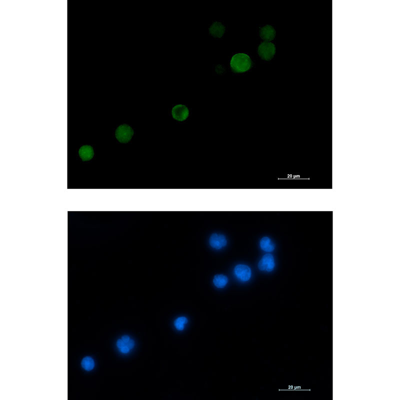 MCAK Rabbit mAb