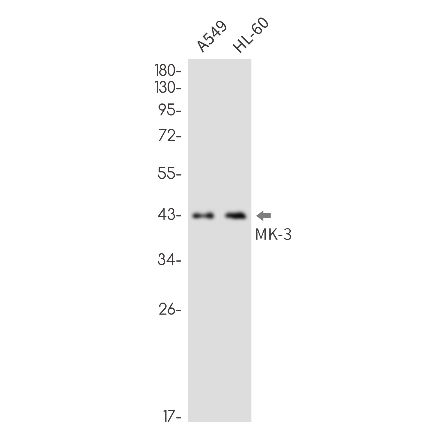 MAPKAP Kinase 3 Rabbit mAb