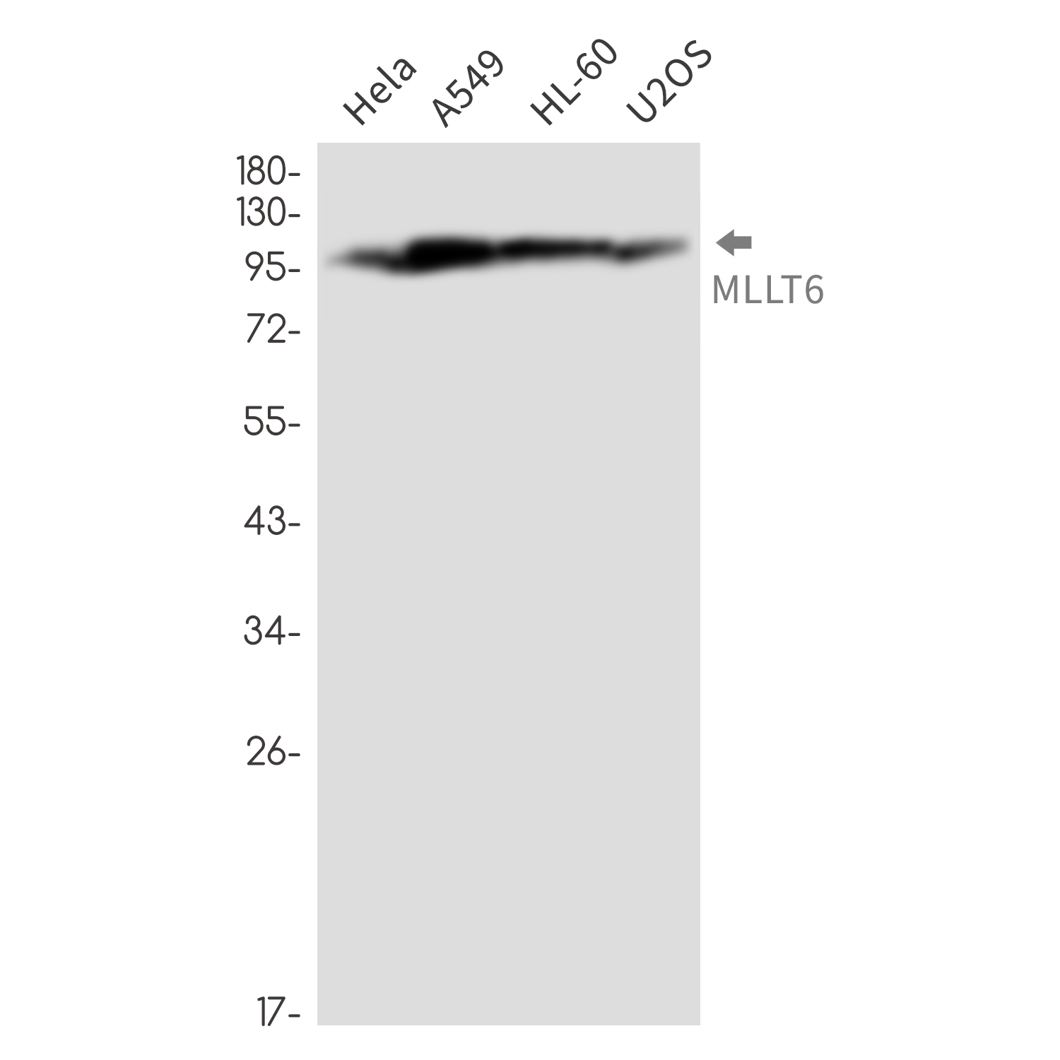 MLLT6 Rabbit mAb