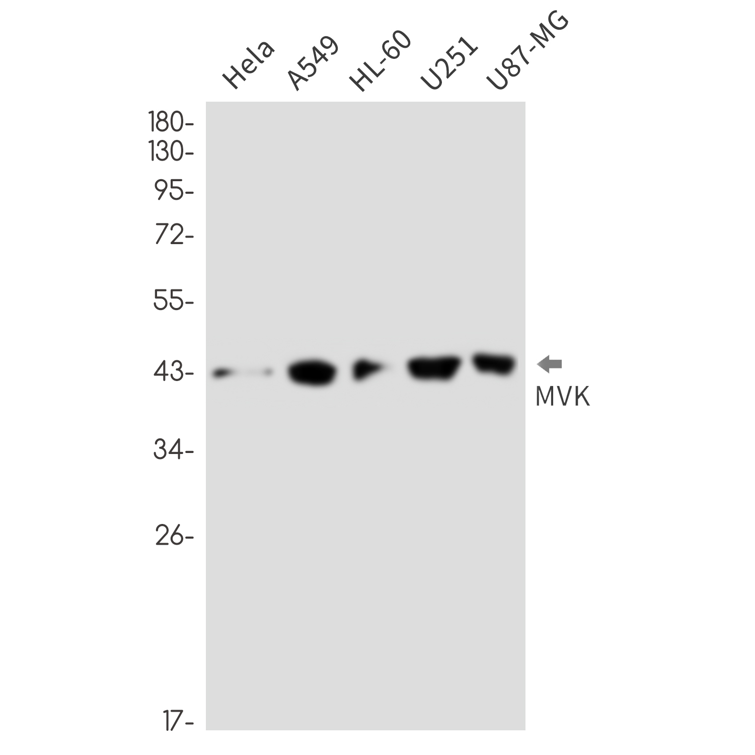 MVK Rabbit mAb