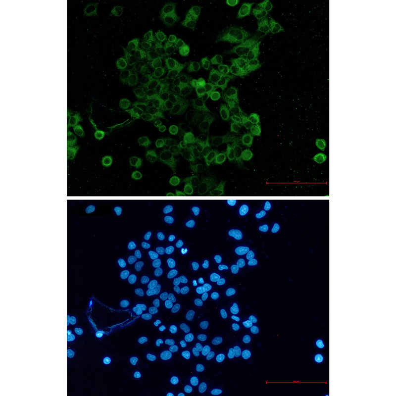 Nectin 2 Rabbit mAb
