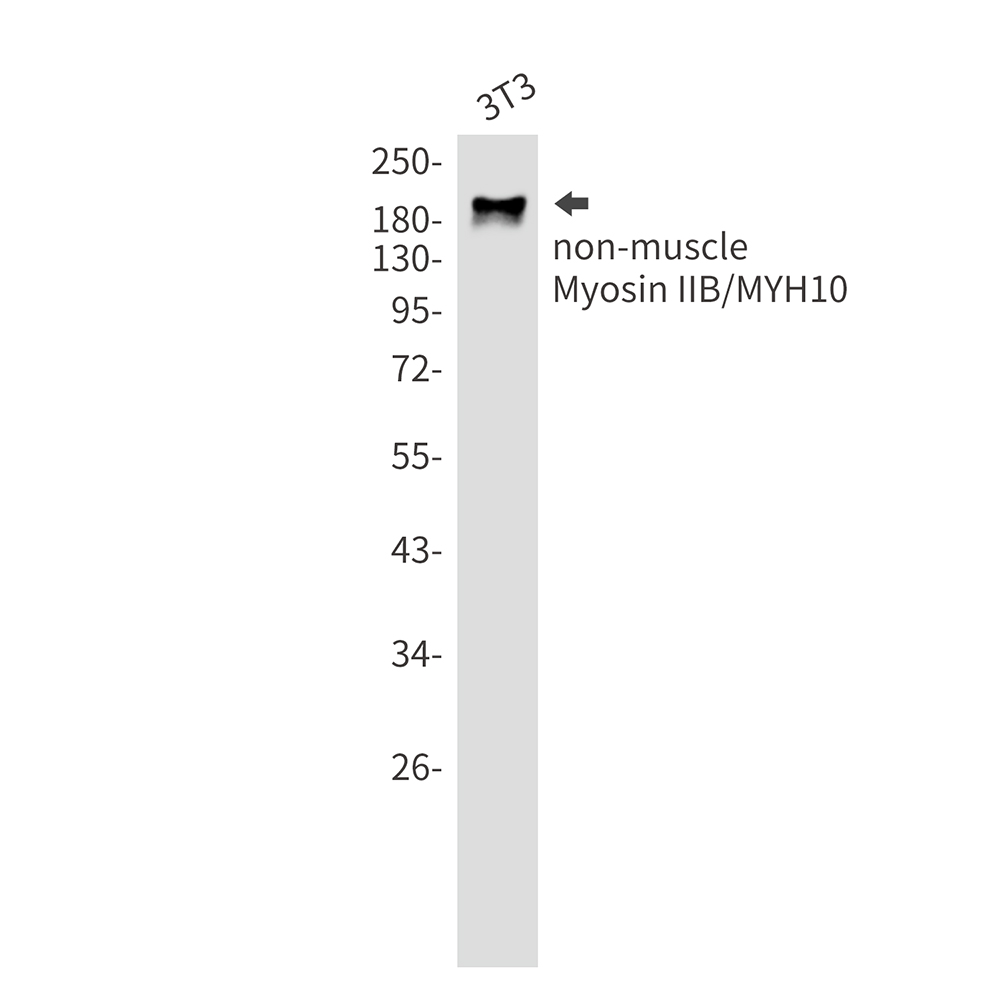MYH10 Rabbit mAb