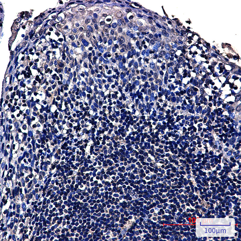 NOP10 Rabbit mAb