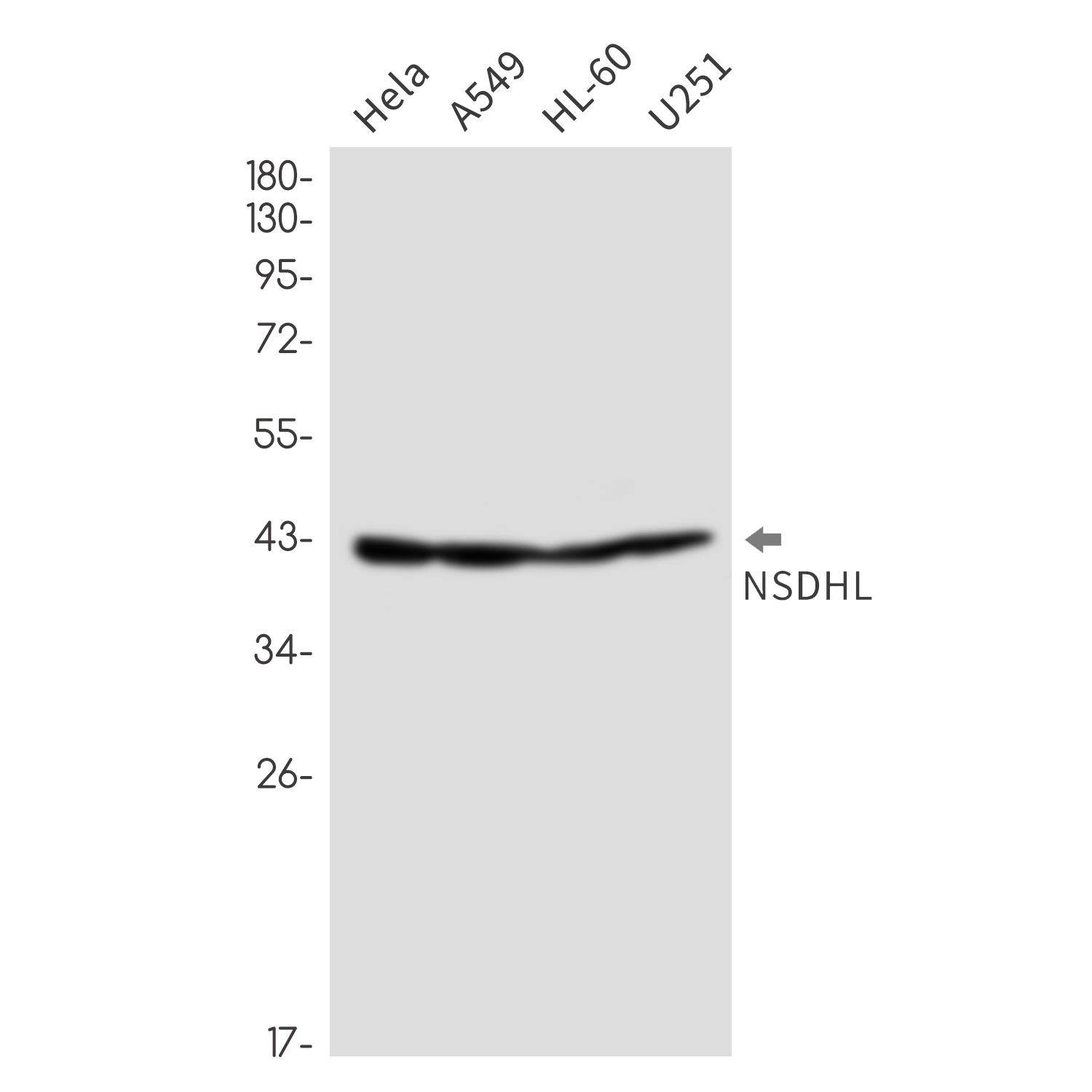 NSDHL Rabbit mAb