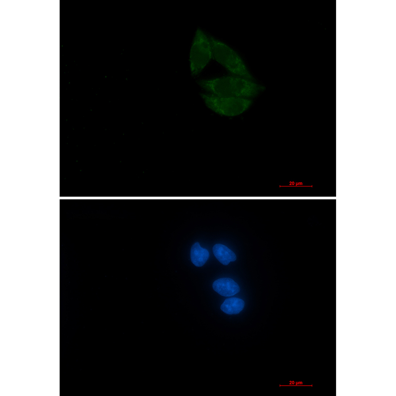 NUP155 Rabbit mAb