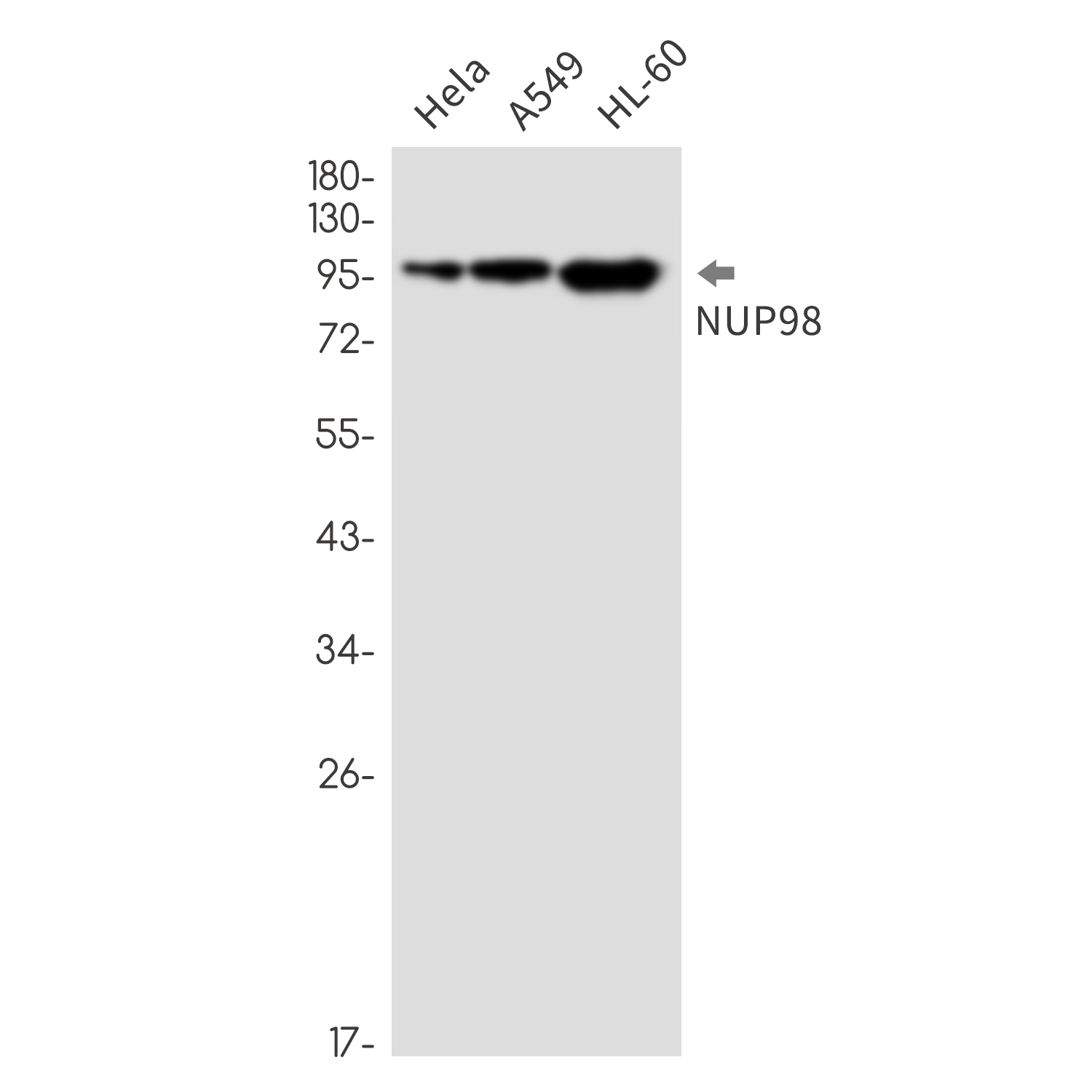 NUP98 Rabbit mAb