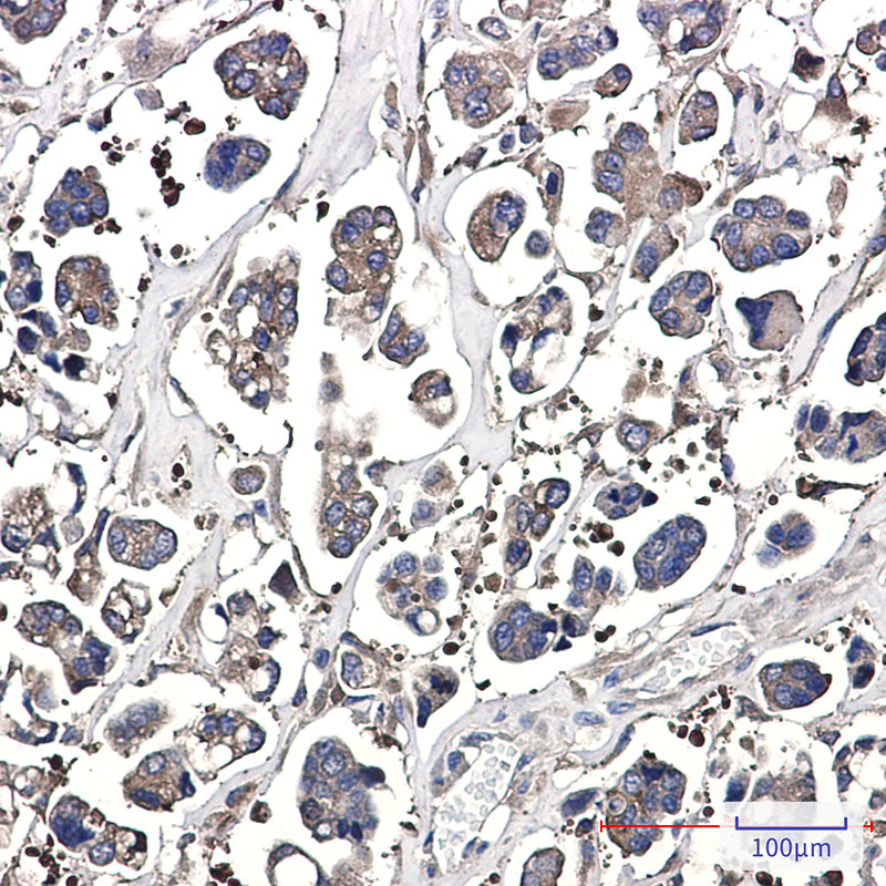 Optineurin Rabbit mAb