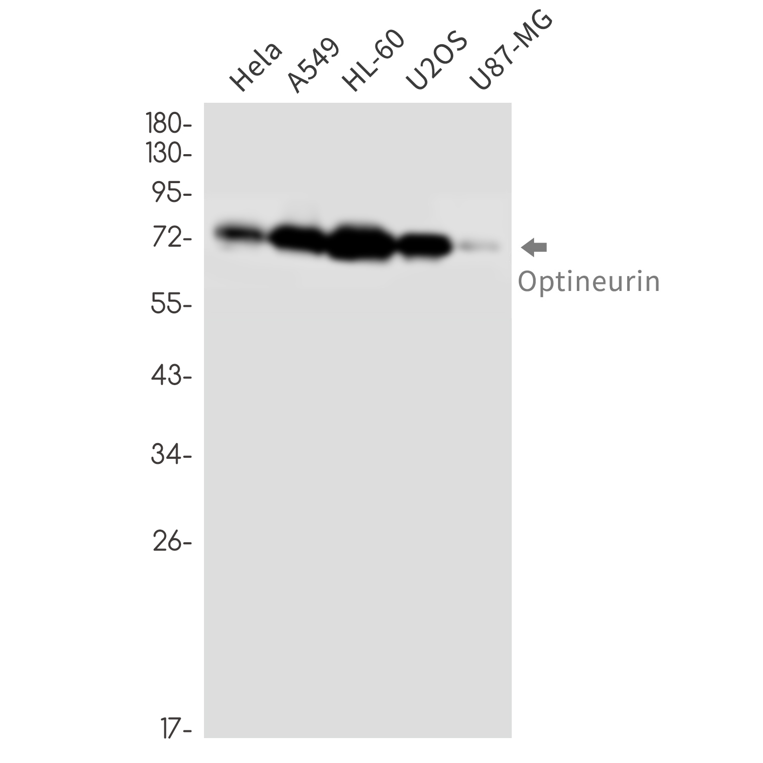 Optineurin Rabbit mAb