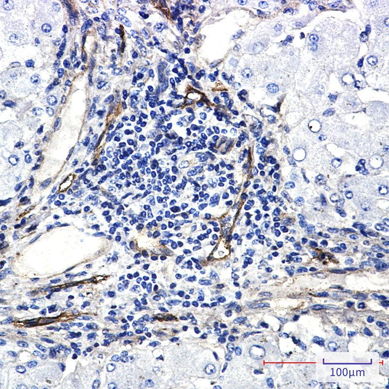 ORAI3 Rabbit mAb