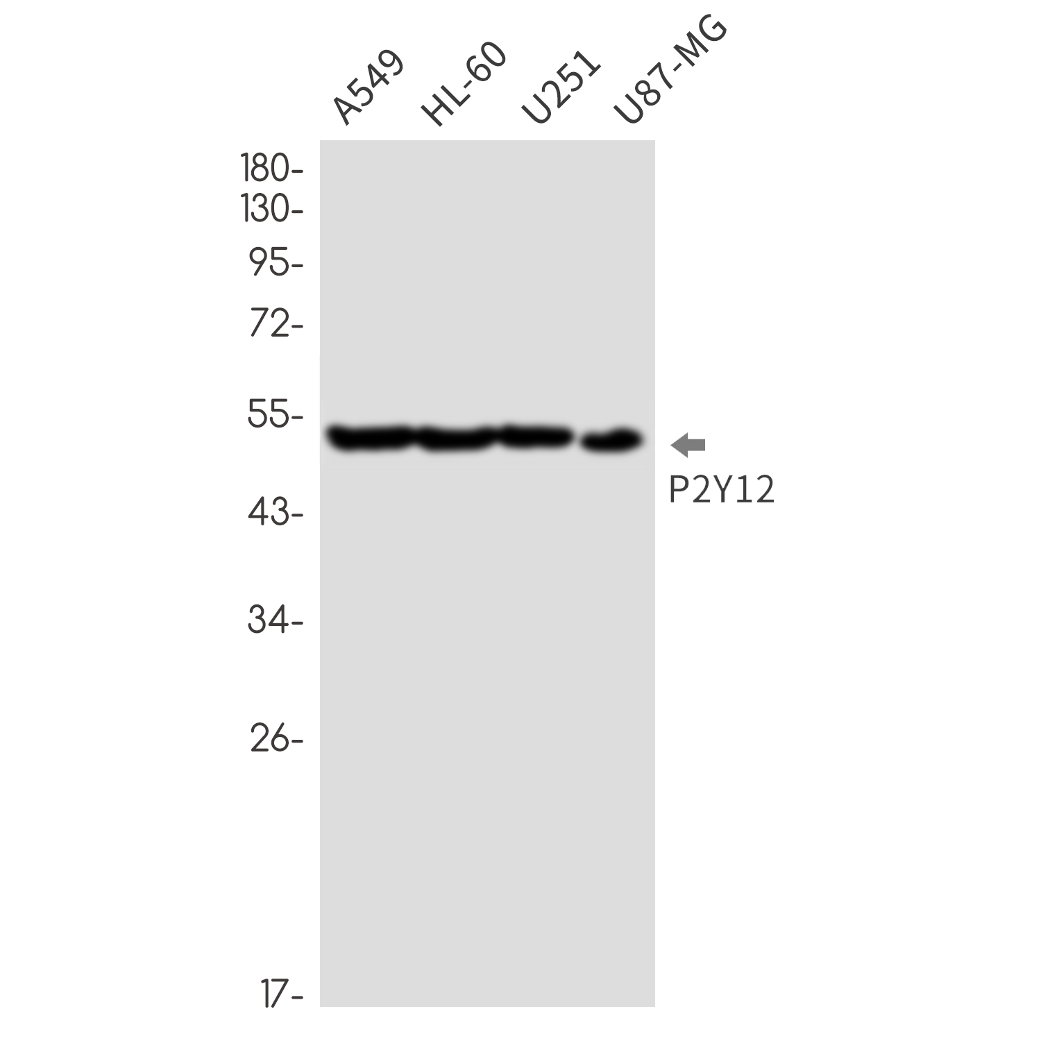 P2Y12 Rabbit mAb