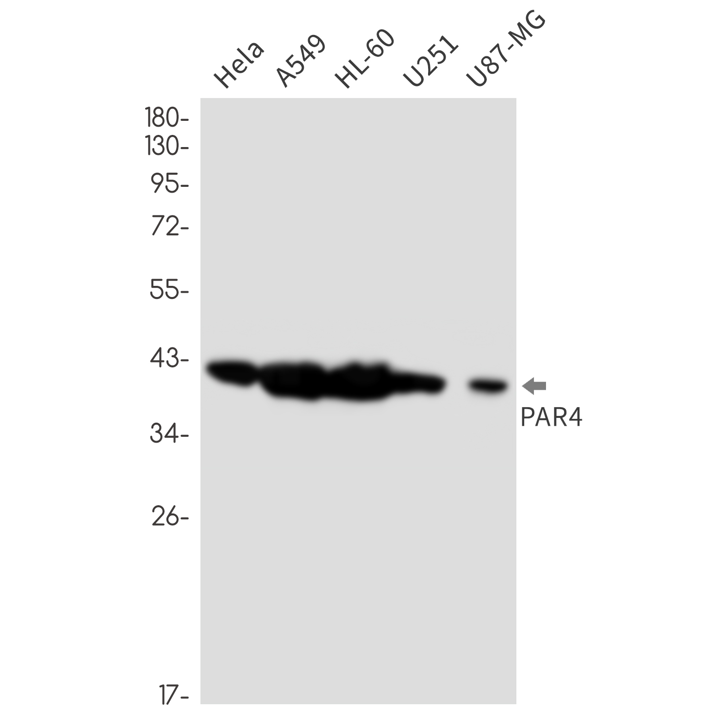PAR4 Rabbit mAb