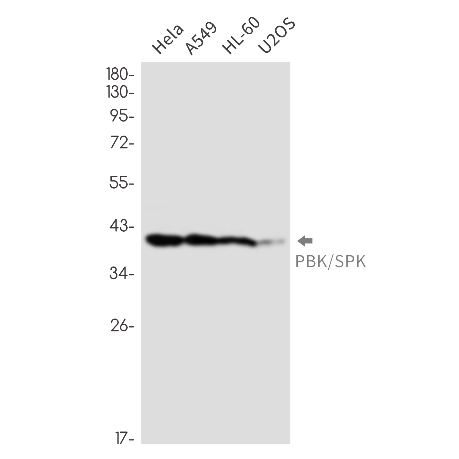 PBK Rabbit mAb