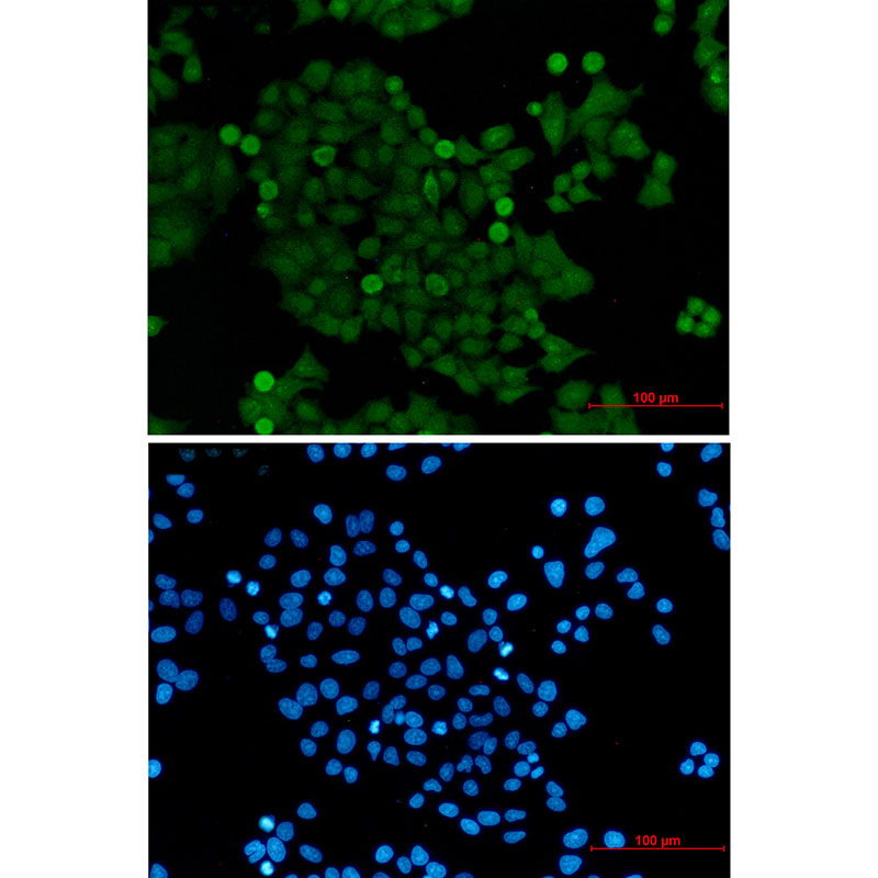 PELP1 Rabbit mAb