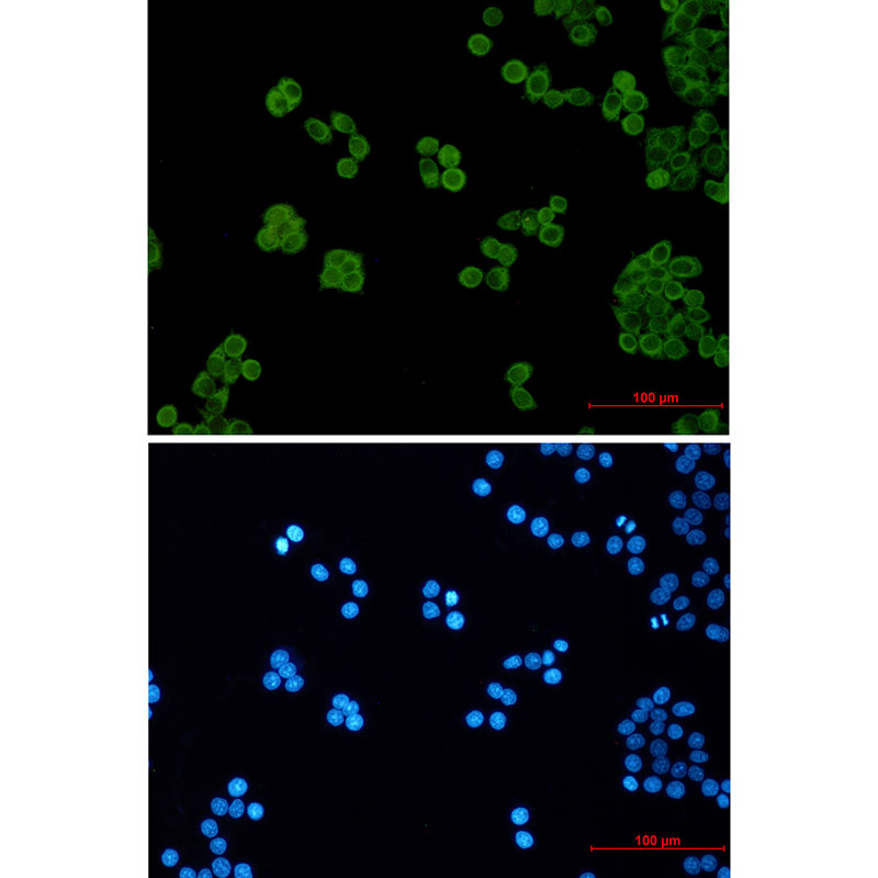 PEN2 Rabbit mAb