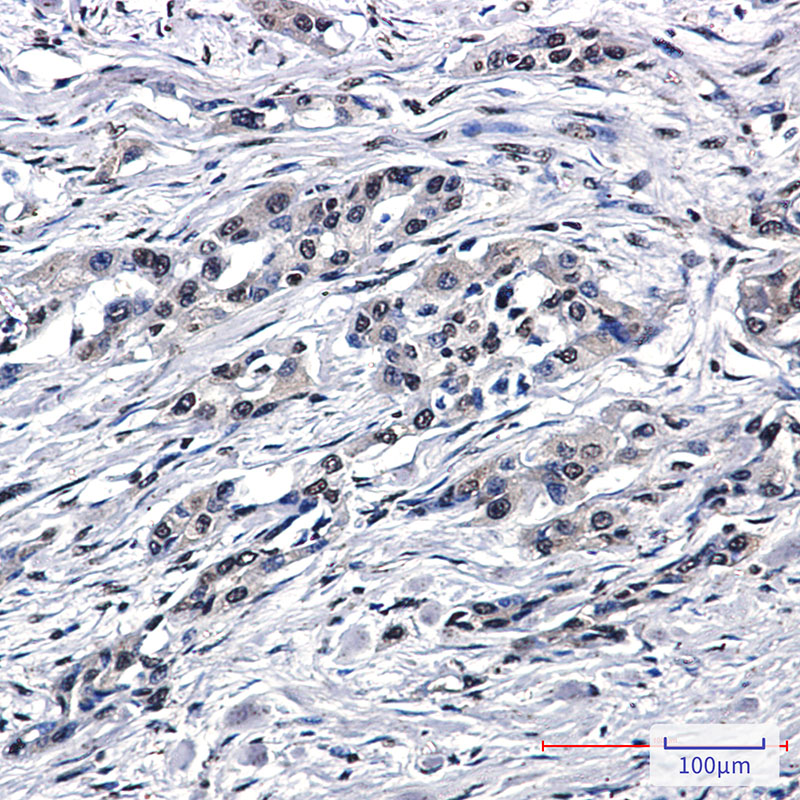 PEN2 Rabbit mAb