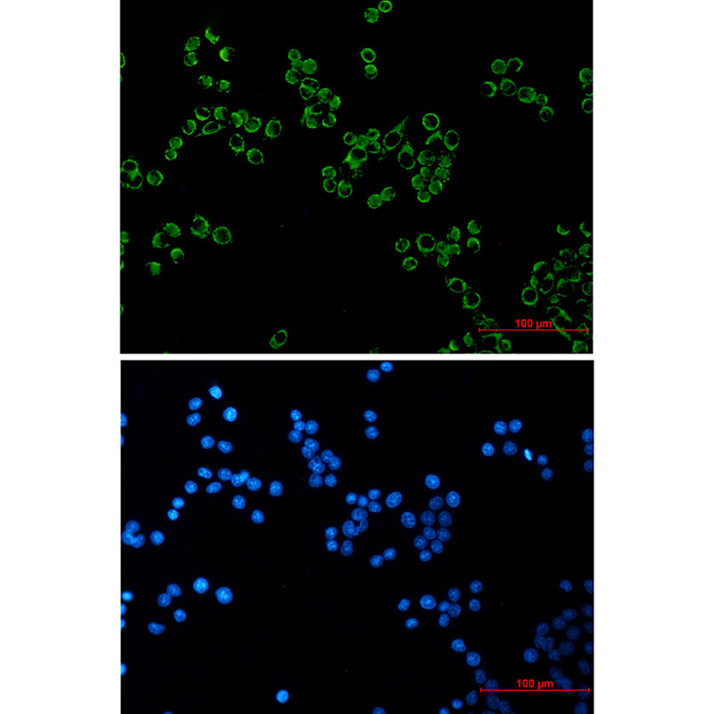 Peroxiredoxin 3 Rabbit mAb