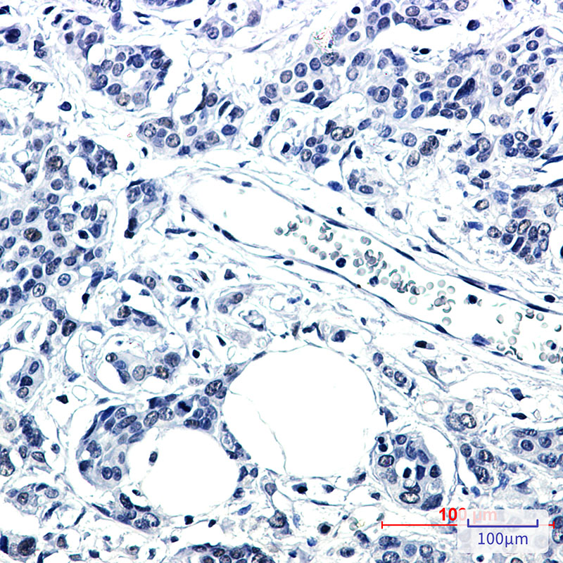 PNKP Rabbit mAb
