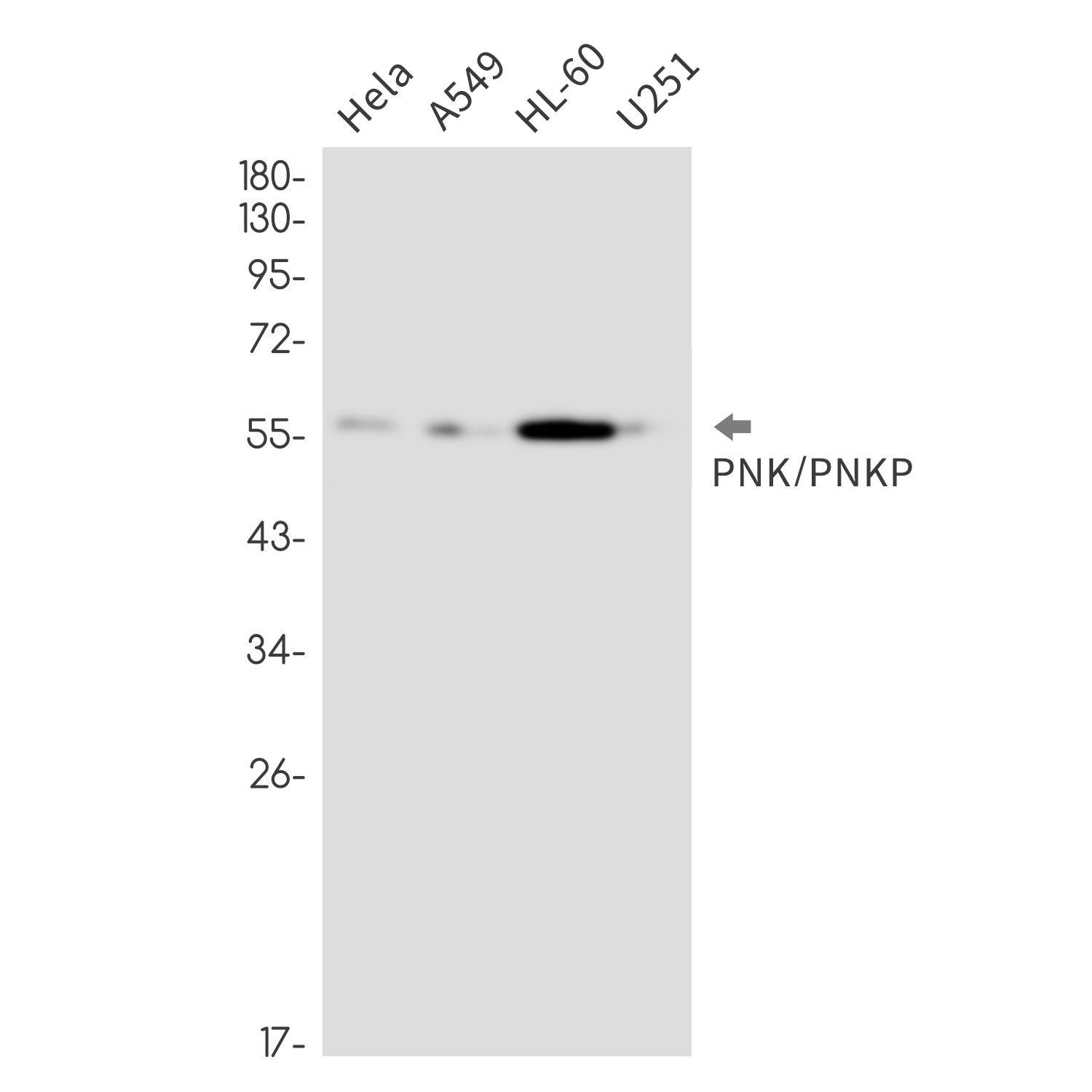 PNKP Rabbit mAb