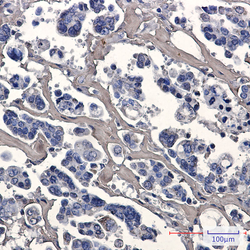 Caspase 7 Rabbit mAb