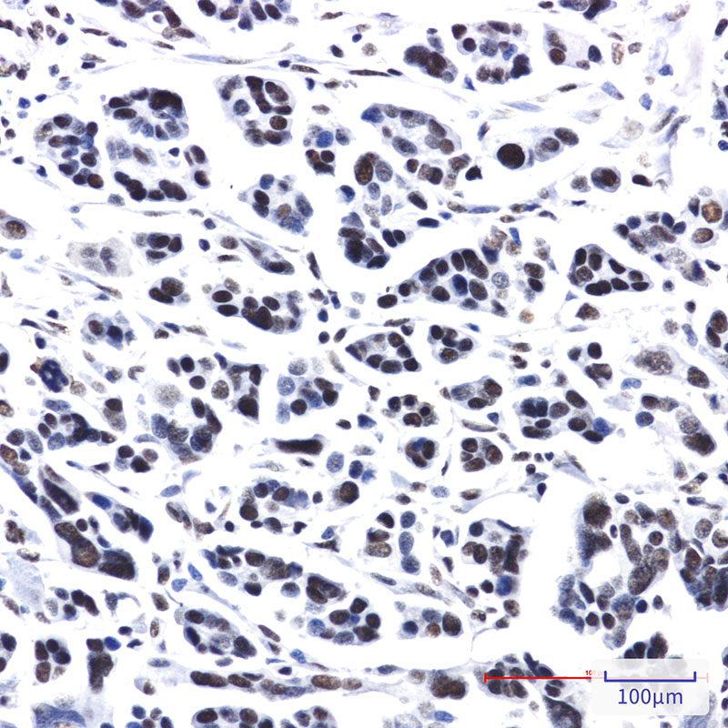 PRPF4 Rabbit mAb