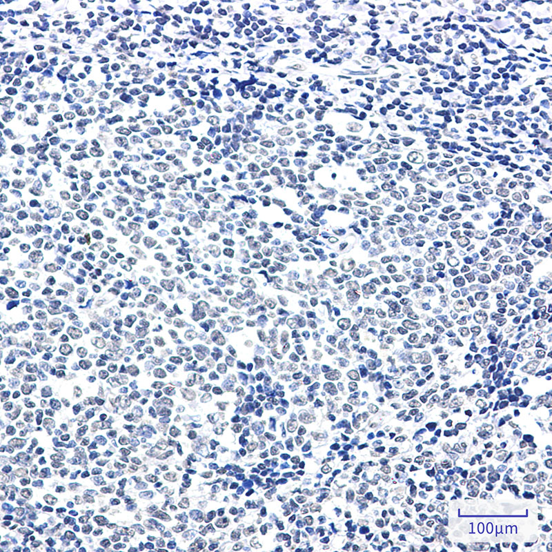 PTBP1 Rabbit mAb