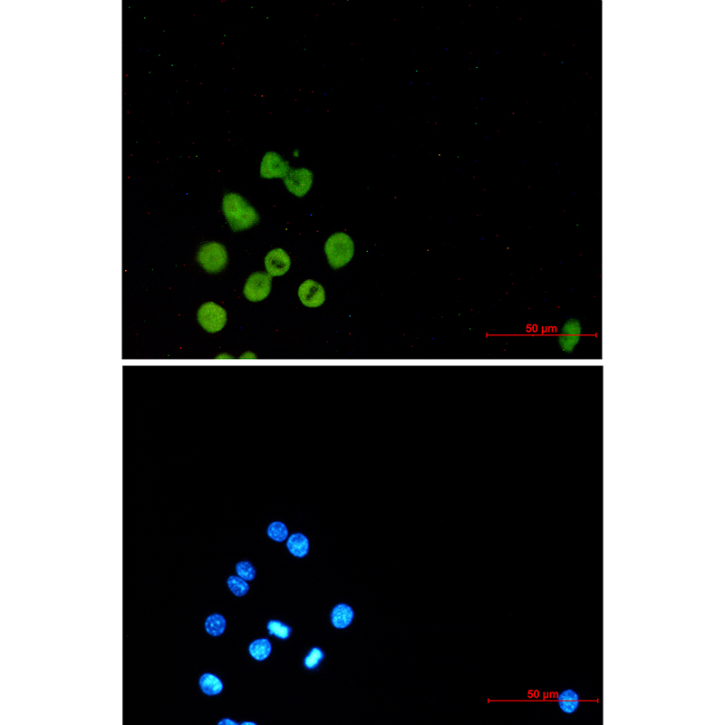 SPI1 Rabbit mAb