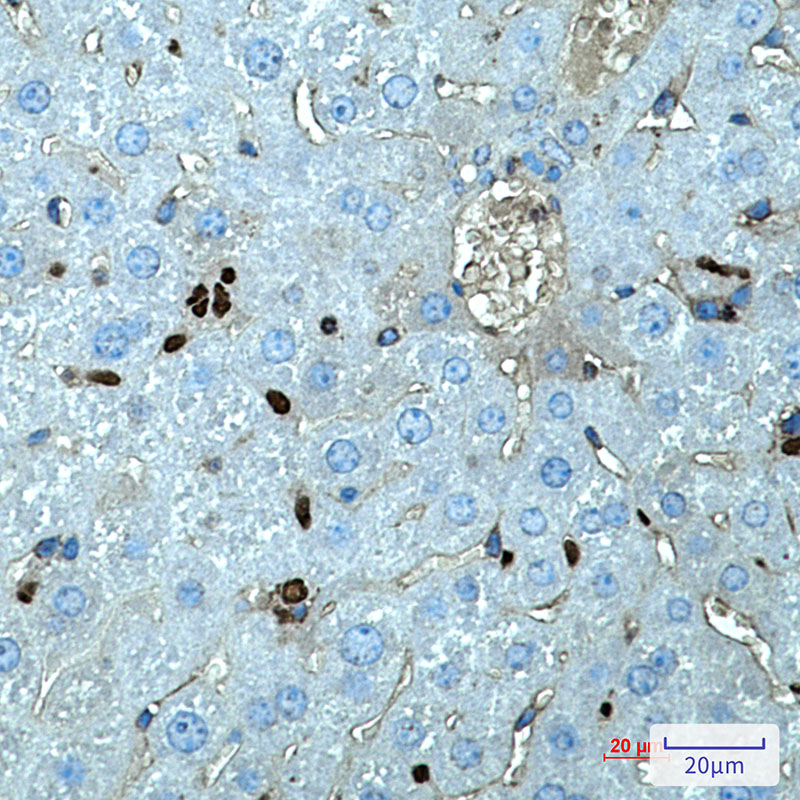 SPI1 Rabbit mAb