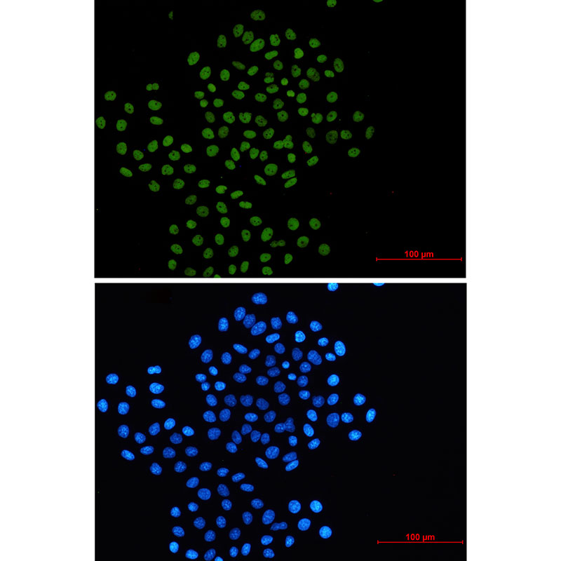 Rad21 Rabbit mAb