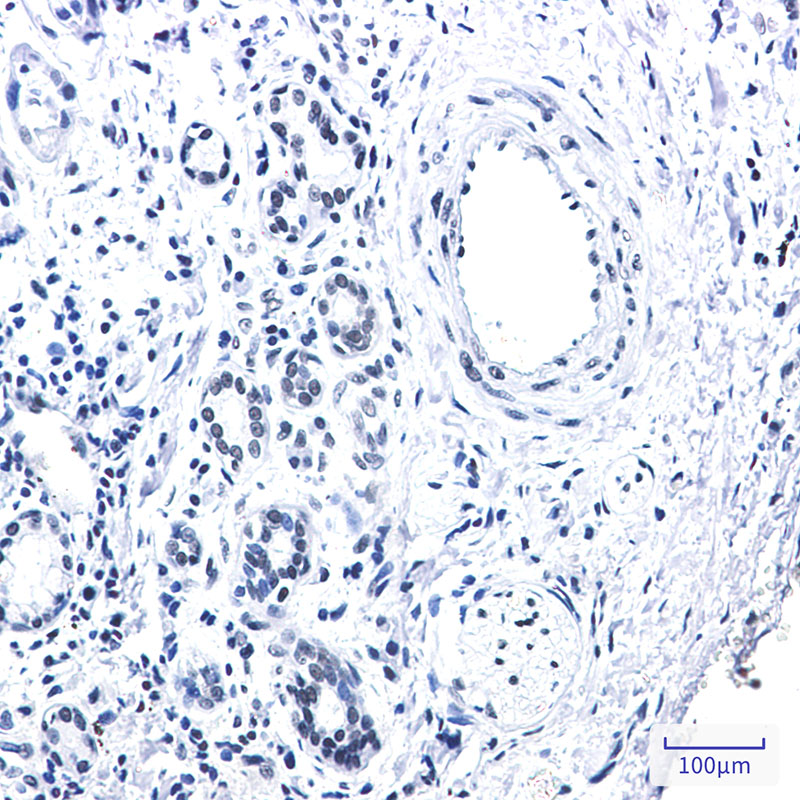 Rad21 Rabbit mAb