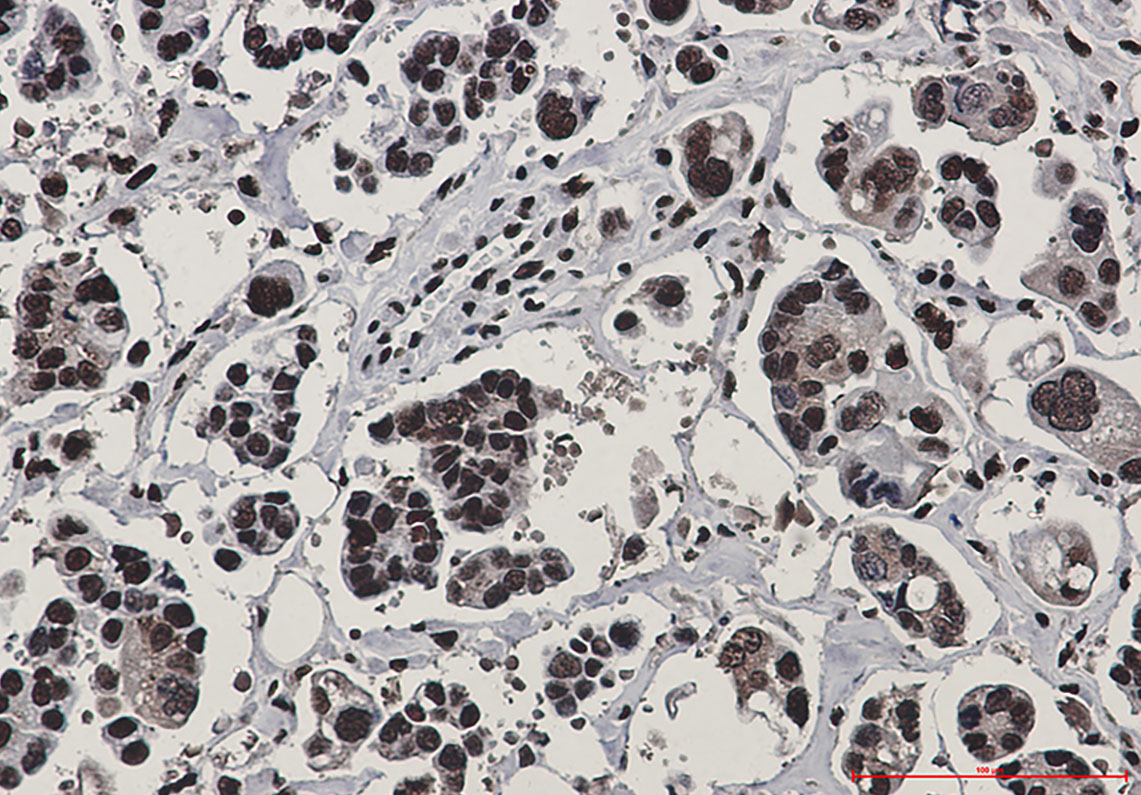 Rad50 Rabbit mAb