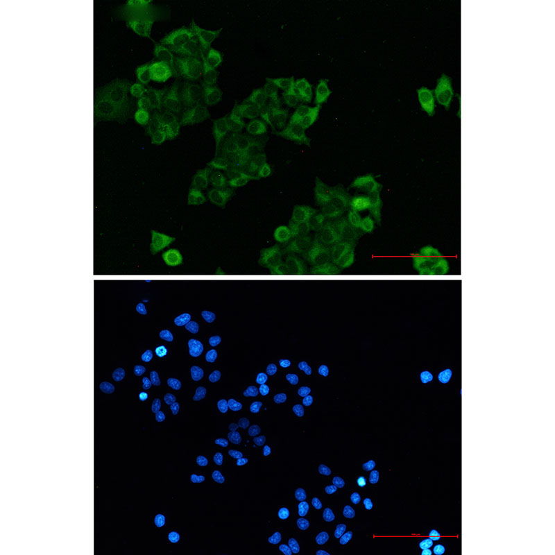 RAIDD Rabbit mAb