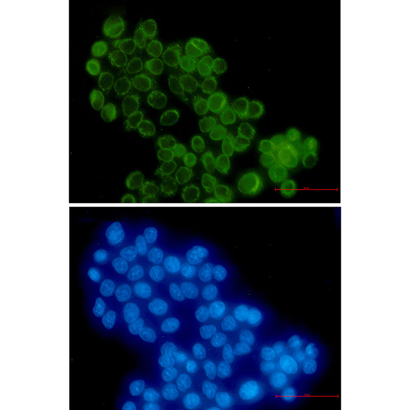 RanGAP1 Rabbit mAb