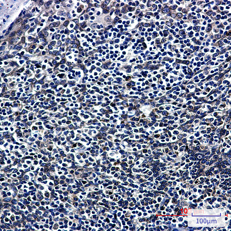 RanGAP1 Rabbit mAb