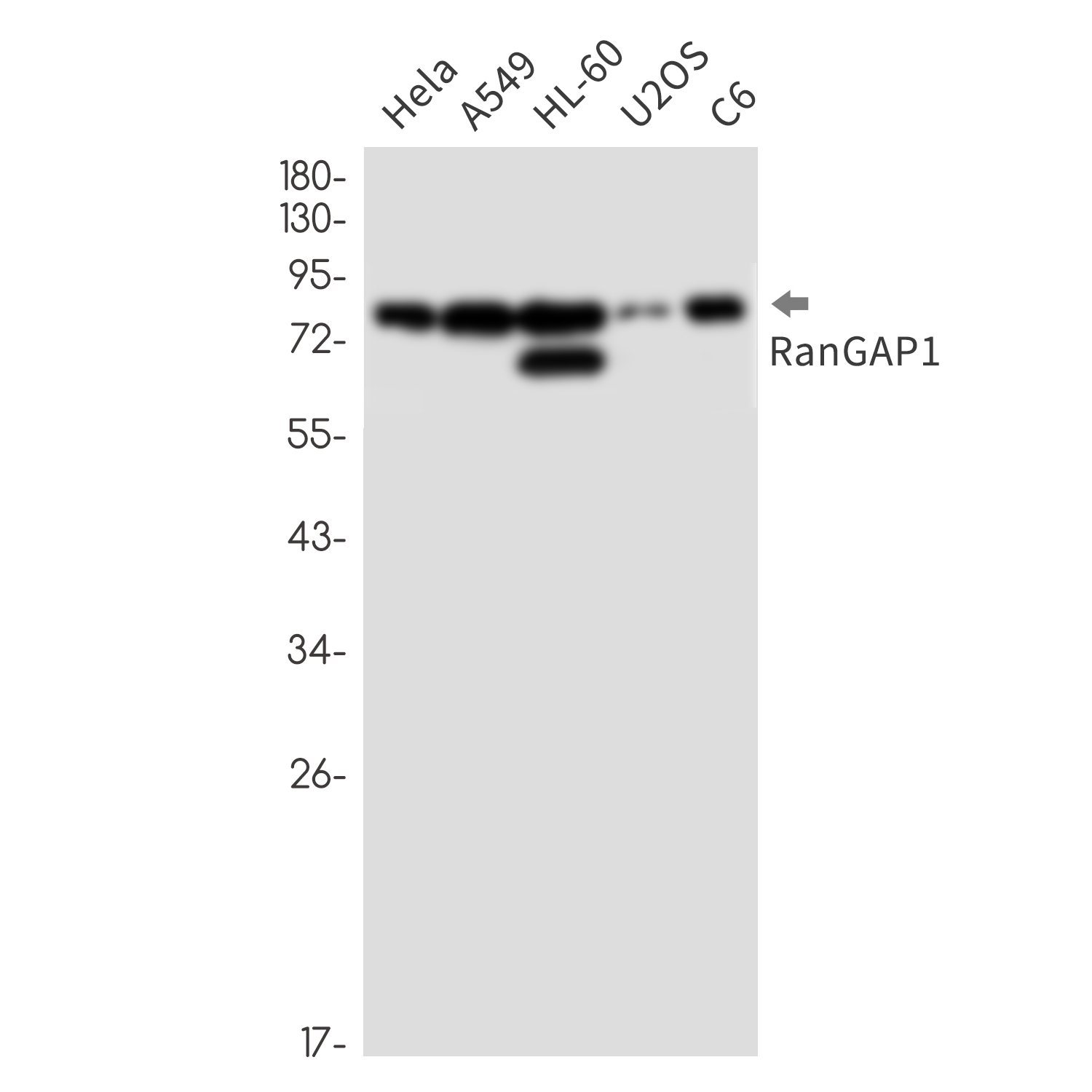 RanGAP1 Rabbit mAb