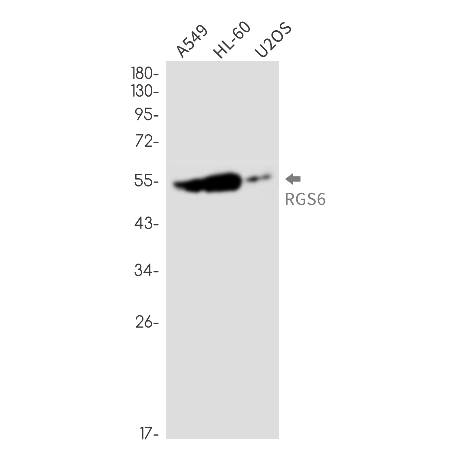 RGS6 Rabbit mAb