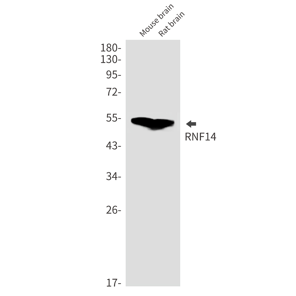 RNF14 Rabbit mAb