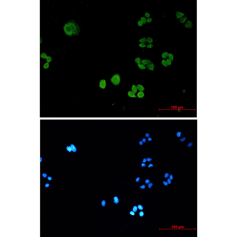 SBDS Rabbit mAb