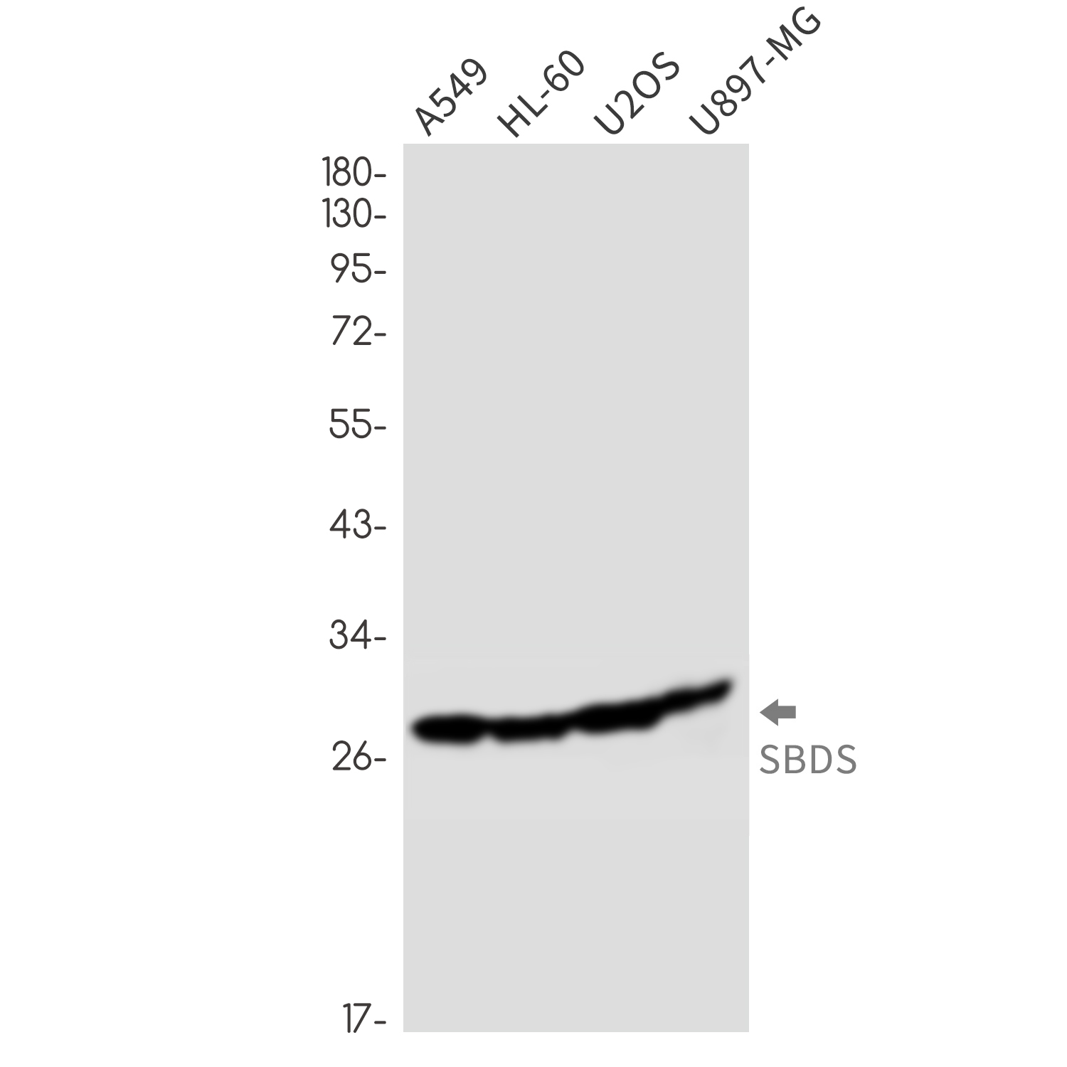 SBDS Rabbit mAb