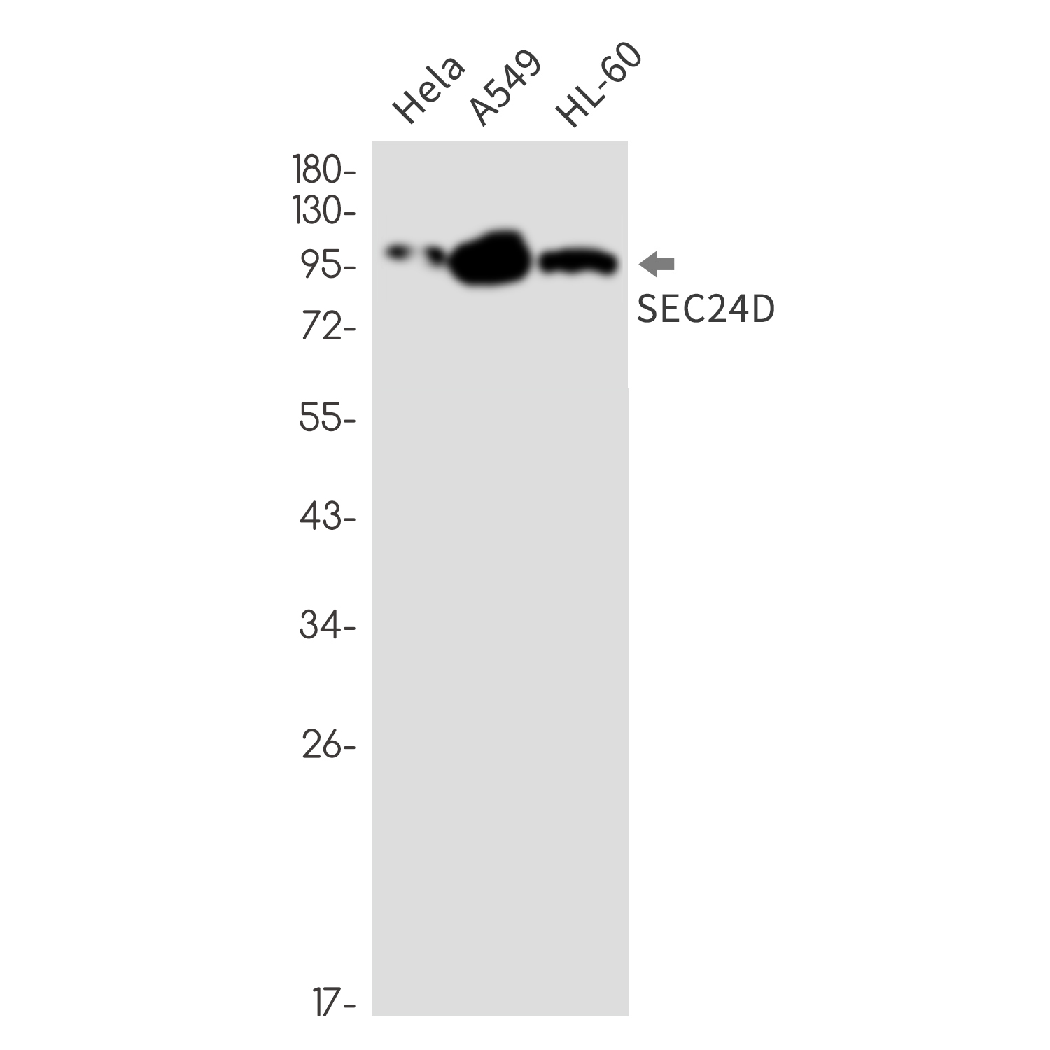 SEC24D Rabbit mAb