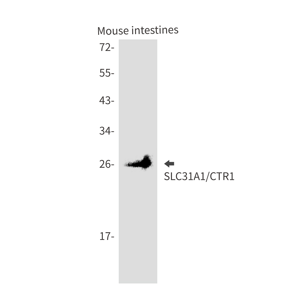 SLC31A1 Rabbit mAb