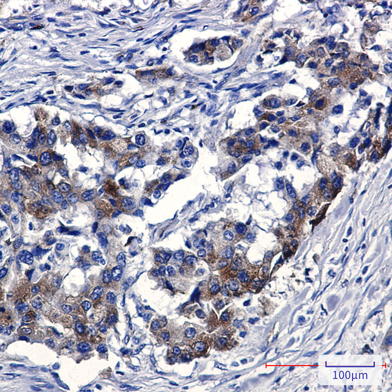 Sortilin Rabbit mAb