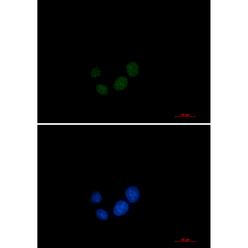 SPT5 Rabbit mAb