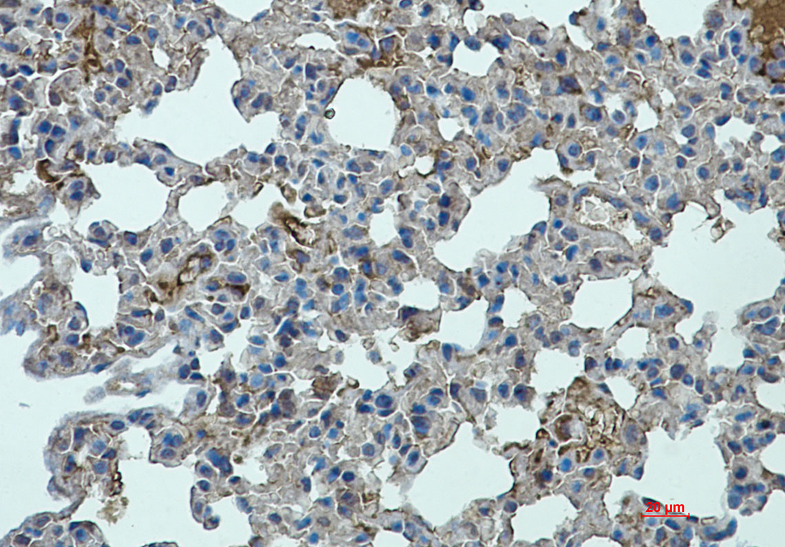 STAT2 Rabbit mAb