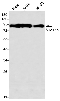 STAT5b Rabbit mAb